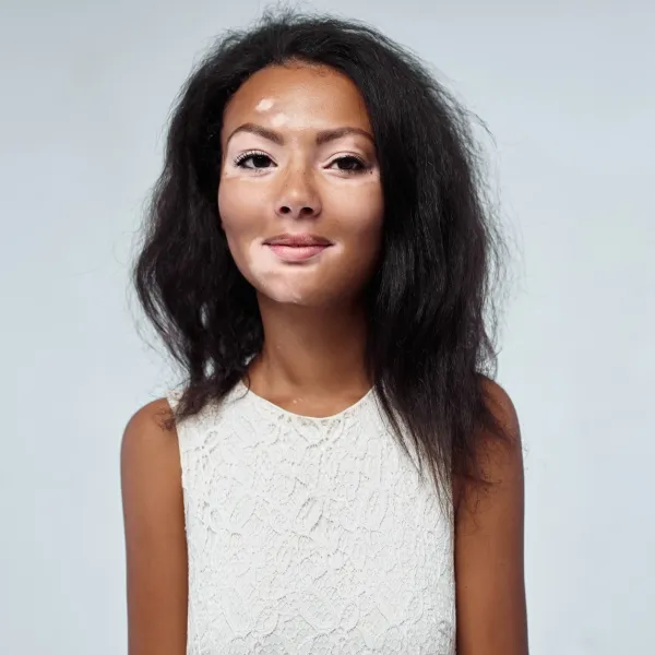 Growth Factor Therapy 