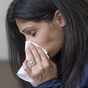 Allergies