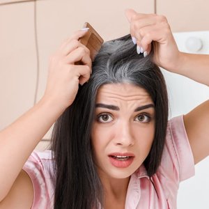 Premature Grey Hair