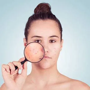  Bacterial & Fungal Skin Infections