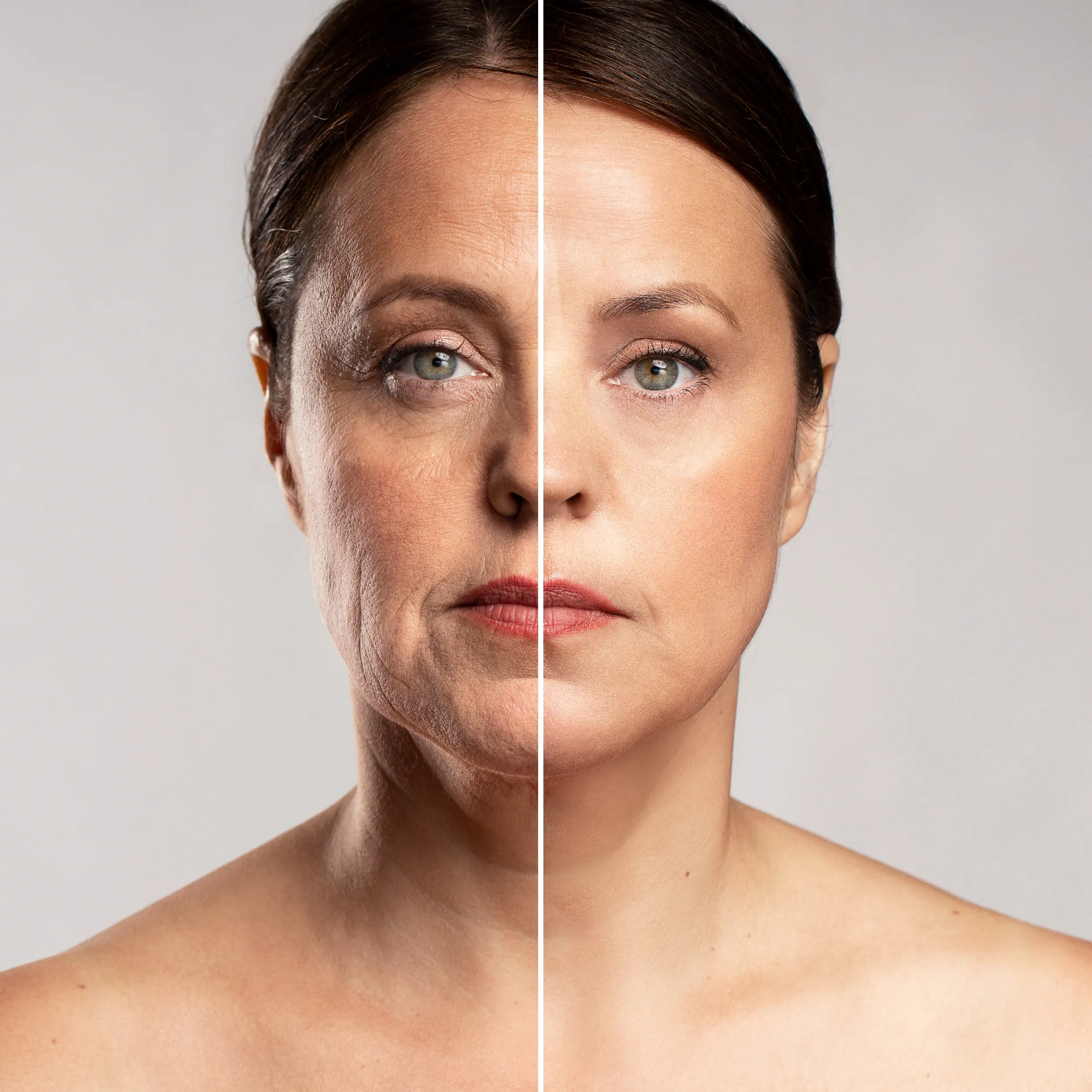 Unwanted Facial Hair